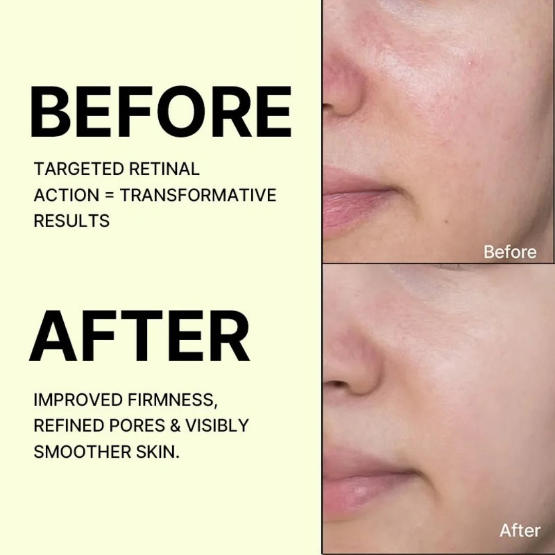 Celimax The Vita-A Retinal Shot Tightening Booster – Nano Retinal Firming Serum