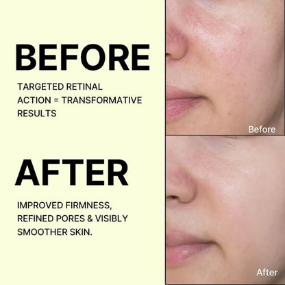 Celimax The Vita-A Retinal Shot Tightening Booster – Nano Retinal Firming Serum