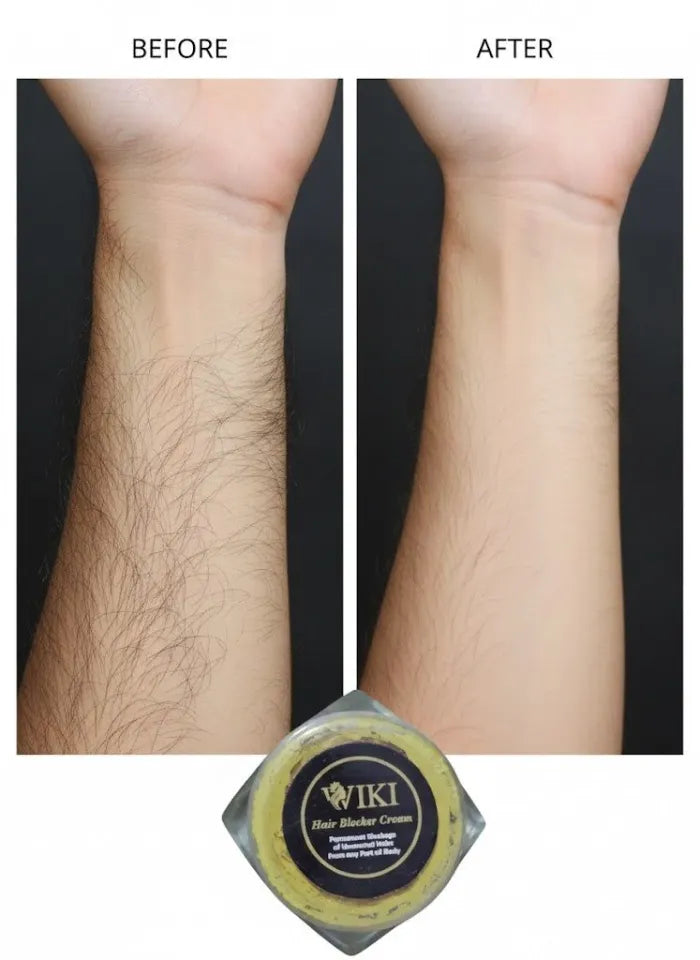 Wiki Hair Blocker Cream – Unwanted Hair Reduction Cream for Face & Body